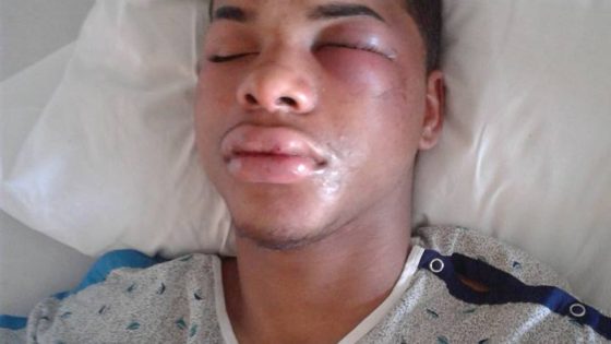 Carteret police beat teen